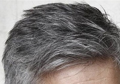 جلوگیری از سفیدی مو با پوست سیب زمینی