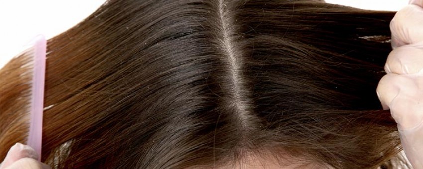 چگونه یک شامپوی ضد شوره خوب انتخاب کنیم؟