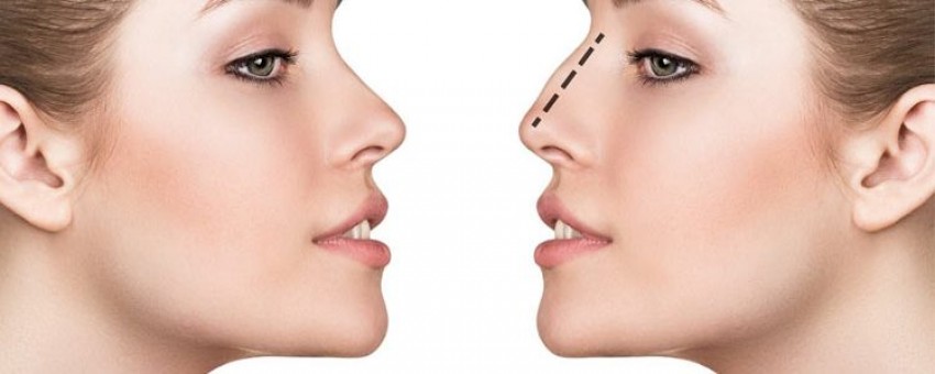 عوارض جانبی جراحی زیبایی بینی