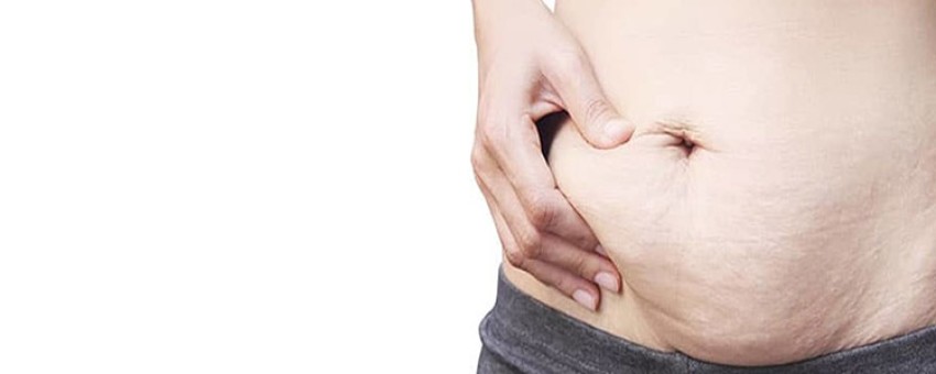 علت شل شدن پوست بعد از کاهش وزن چیست؟